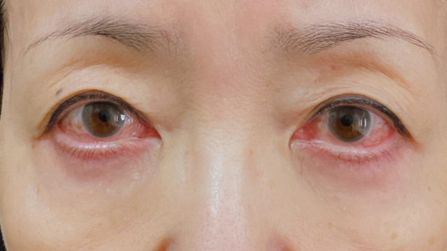 Postoperative Condition Part 1