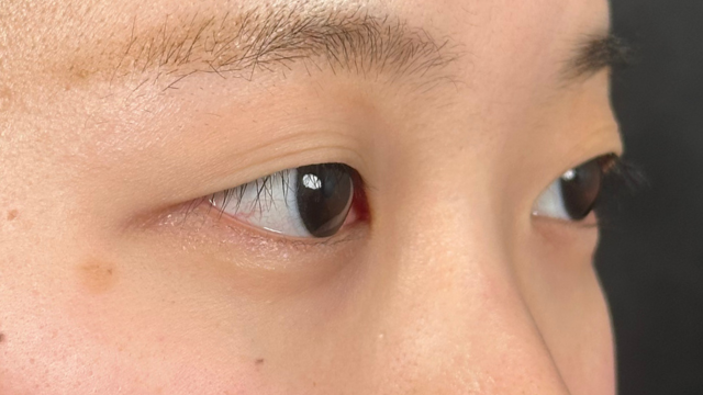 Postoperative Condition Part 1