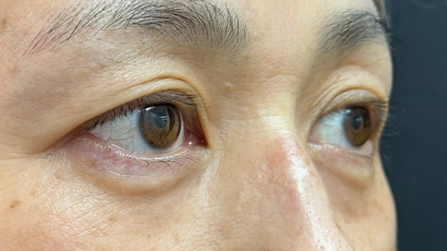 Postoperative Condition Part 1