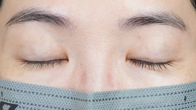 Postoperative Condition Part 1