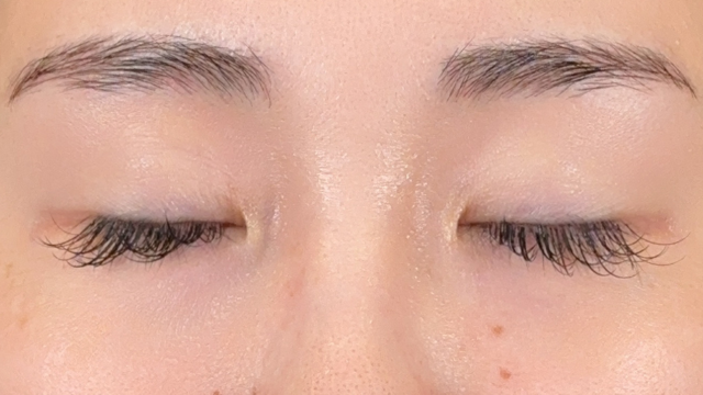 Postoperative Condition Part 1