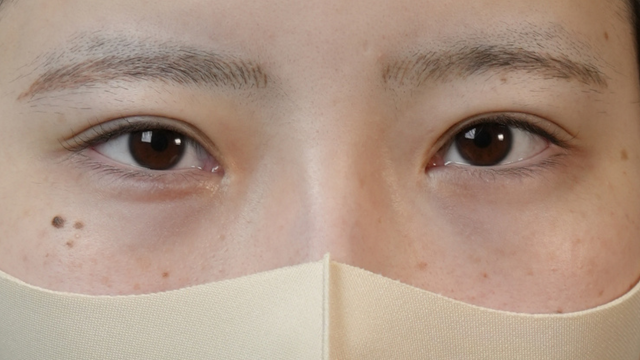 Postoperative Condition Part 1