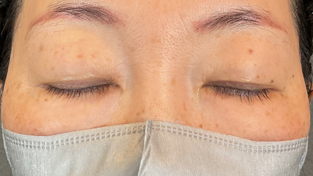 Postoperative Condition Part 1