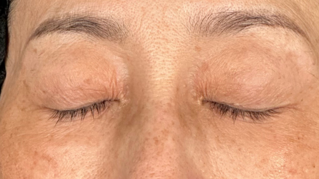 Postoperative Condition Part 1