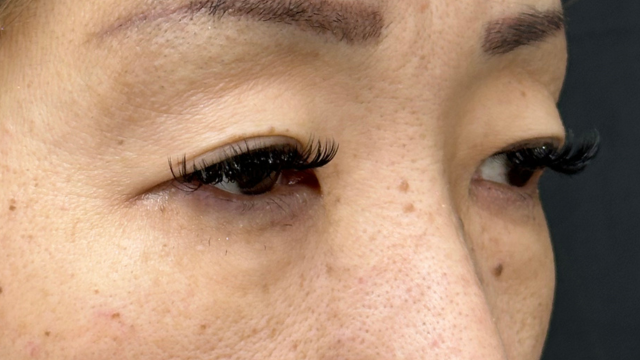 手术前的状态 其一