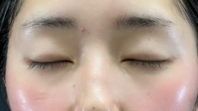 Postoperative Condition Part 1