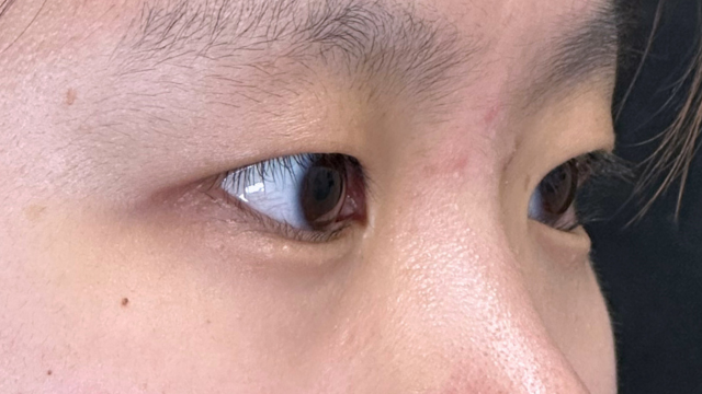 Postoperative Condition Part 1