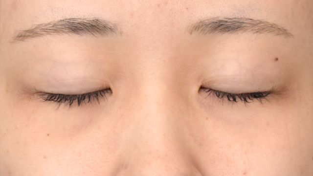 Postoperative Condition Part 1