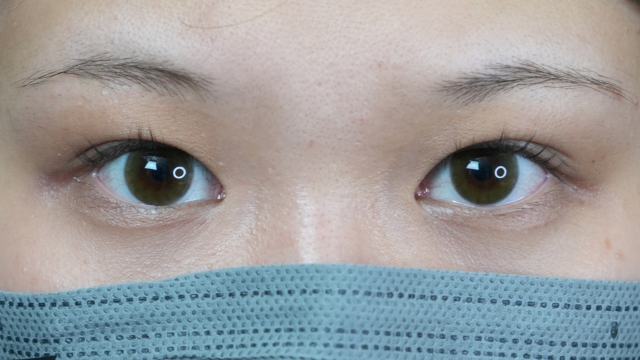 Postoperative Condition Part 1