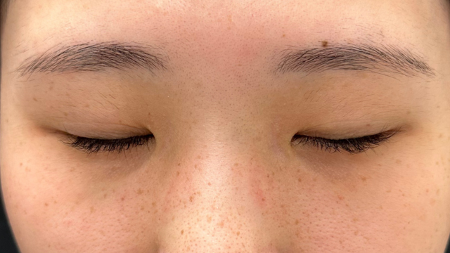 Postoperative Condition Part 1