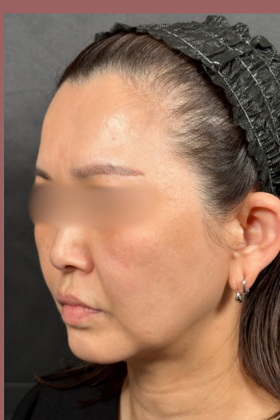 Postoperative Condition Part 1