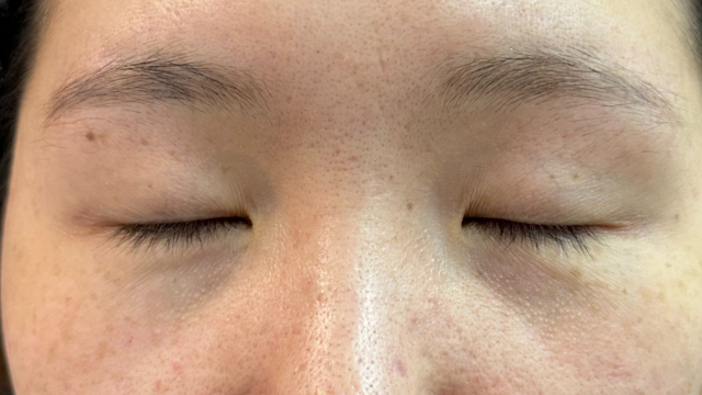 Postoperative Condition Part 1