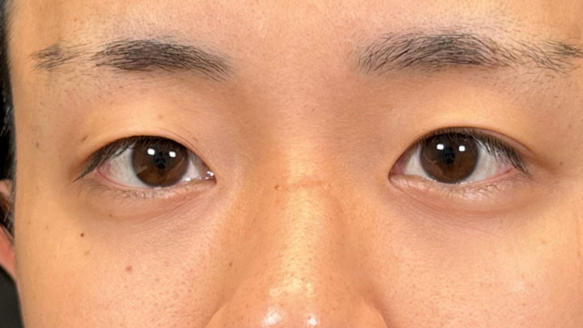 Postoperative Condition Part 1