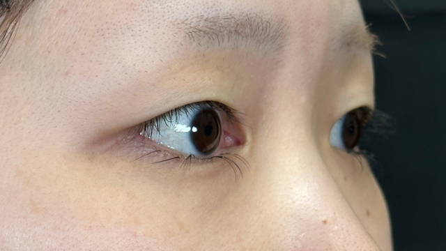 Postoperative Condition Part 1