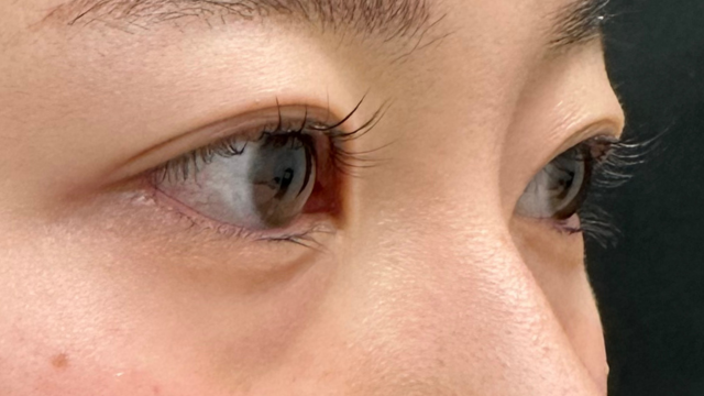 Postoperative Condition Part 1