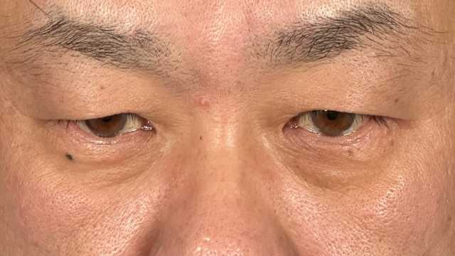 Postoperative Condition Part 1