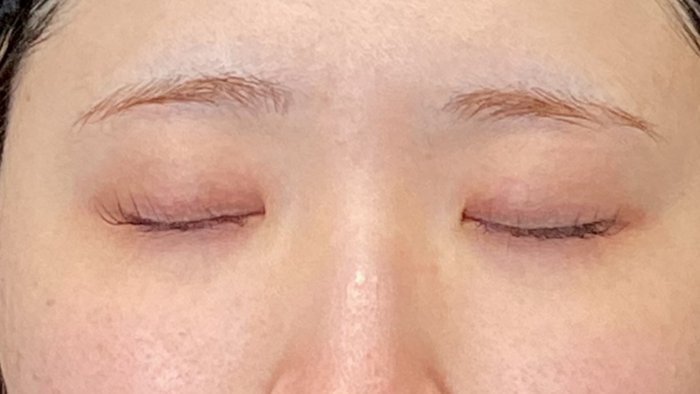 Postoperative Condition Part 1