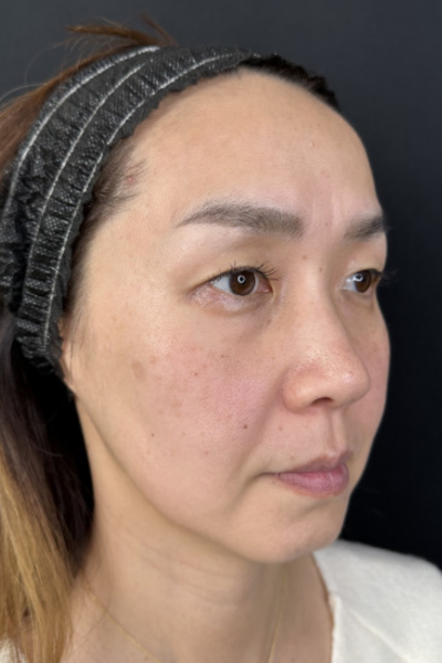 手術前の状態 その1