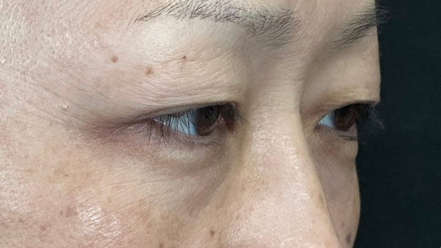 Postoperative Condition Part 1