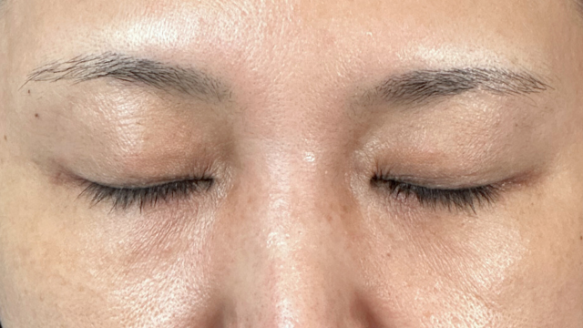 Postoperative Condition Part 1