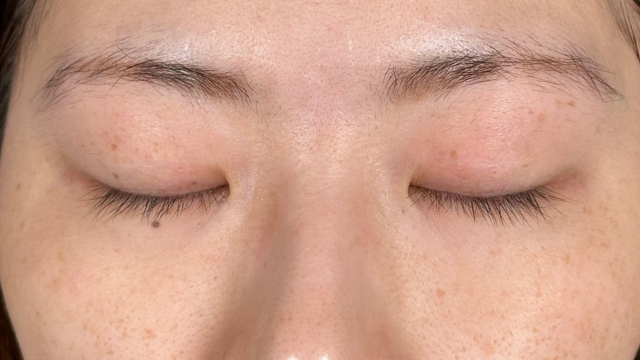 Postoperative Condition Part 1