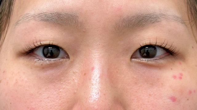 Postoperative Condition Part 1