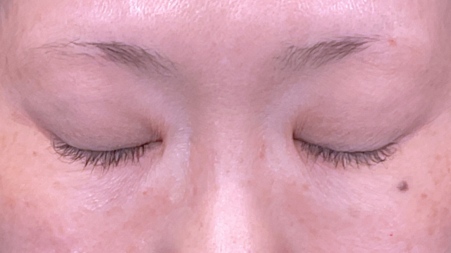 Postoperative Condition Part 1