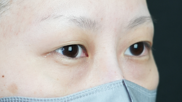 Postoperative Condition Part 1