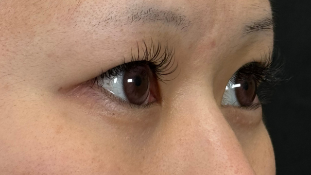 Postoperative Condition Part 1