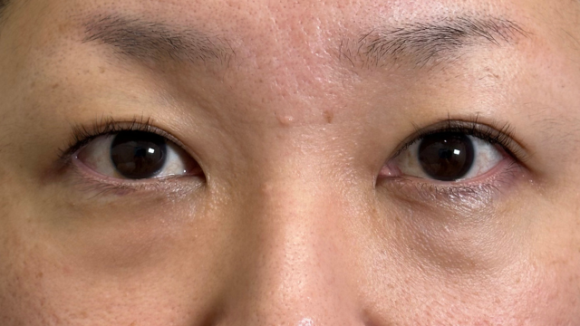 Postoperative Condition Part 1