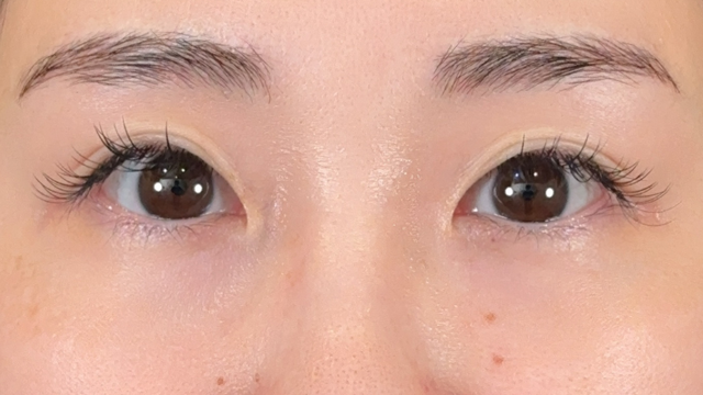 Postoperative Condition Part 1