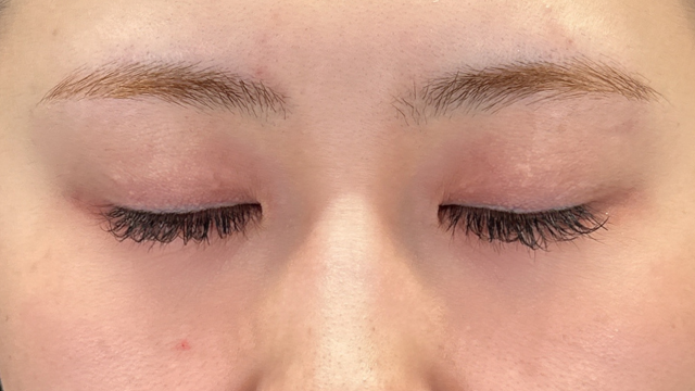 Postoperative Condition Part 1