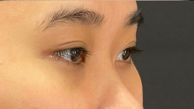 Postoperative Condition Part 1