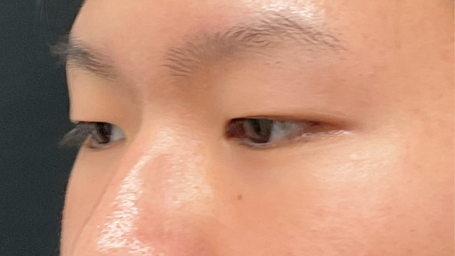 Postoperative Condition Part 1