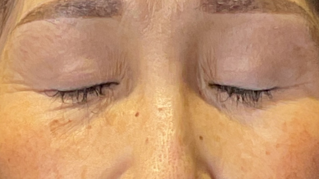 Postoperative Condition Part 1