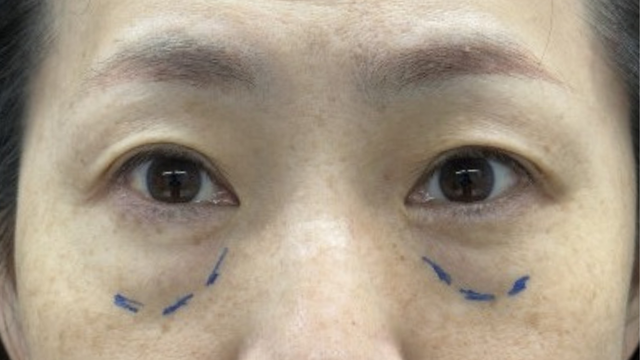 Postoperative Condition Part 1