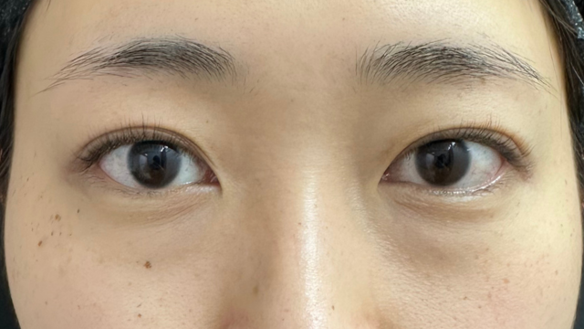 Postoperative Condition Part 1