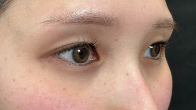 手术前的状态 其一