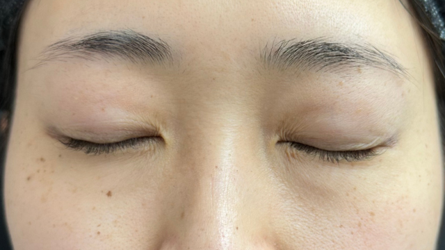 Postoperative Condition Part 1