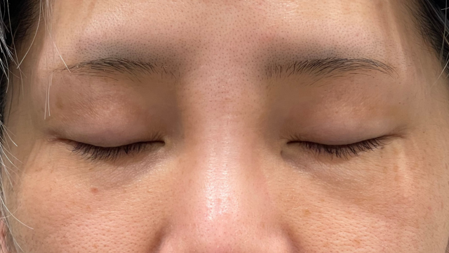 Postoperative Condition Part 1