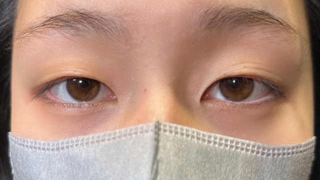 Postoperative Condition Part 1