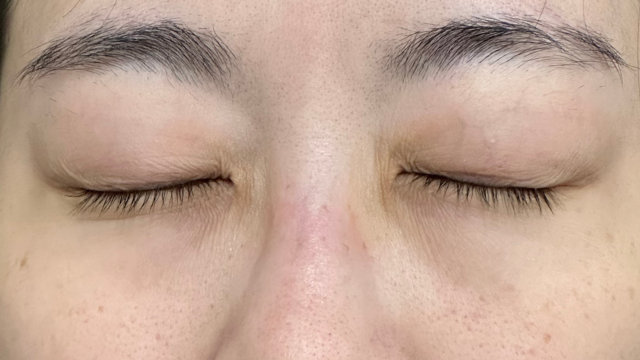 Postoperative Condition Part 1