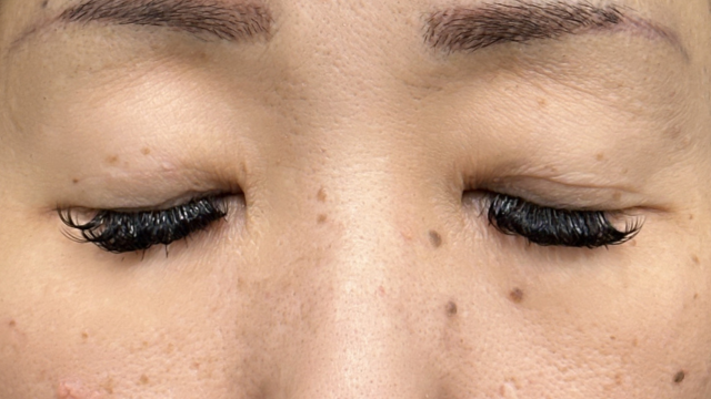 手术前的状态 其一