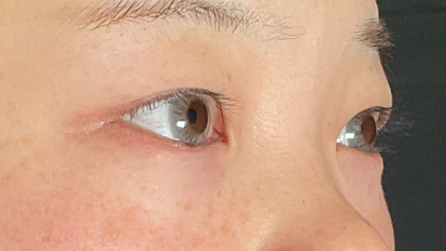 Postoperative Condition Part 1