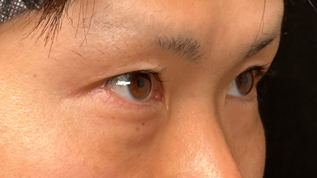 Postoperative Condition Part 1