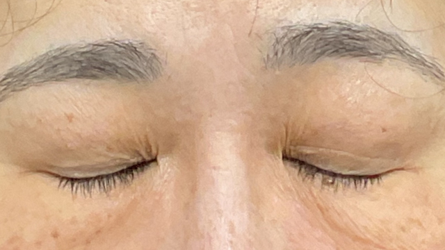 Postoperative Condition Part 1