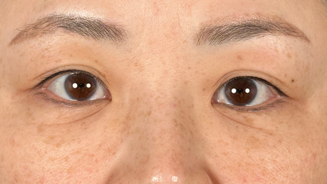 Postoperative Condition Part 1