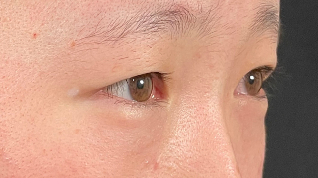 Postoperative Condition Part 1