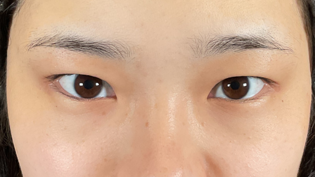 Postoperative Condition Part 1