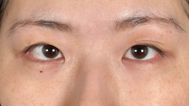 Postoperative Condition Part 1